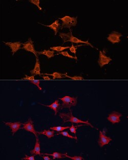 Invitrogen GSTM3 Polyclonal Antibody 100 μL; Unconjugated:Antibodies,