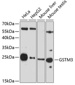 Invitrogen GSTM3 Polyclonal Antibody 100 μL; Unconjugated:Antibodies,