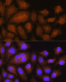 GSTT2B Polyclonal Antibody:Antibodies, Polyclonal