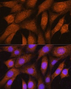 GSTT2B Polyclonal Antibody:Antibodies, Polyclonal
