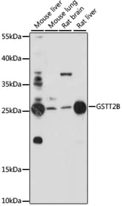 GSTT2B Polyclonal Antibody:Antibodies, Polyclonal