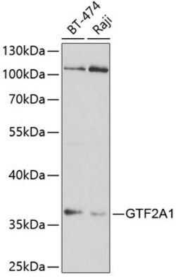 Invitrogen GTF2A1 Polyclonal Antibody 100 μL; Unconjugated:Antibodies,