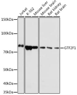 Invitrogen GTF2F1 Polyclonal Antibody 100 &mu;L; Unconjugated:Antibodies,