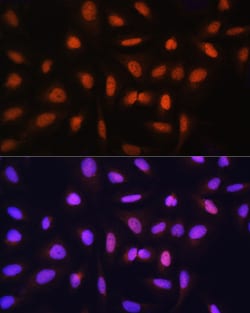 Invitrogen GTF2H1 Polyclonal Antibody 100 μL; Unconjugated:Antibodies,
