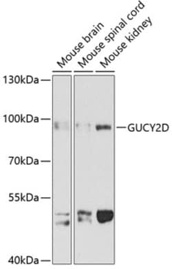 Invitrogen GUCY2D Polyclonal Antibody 100 &mu;L; Unconjugated:Antibodies,
