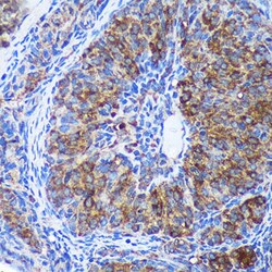 Invitrogen GULP1 Polyclonal Antibody 100 &mu;L; Unconjugated:Antibodies,