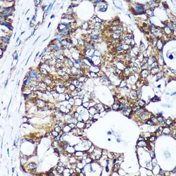 Invitrogen GULP1 Polyclonal Antibody 100 &mu;L; Unconjugated:Antibodies,