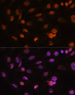 Invitrogen H2AFV Polyclonal Antibody 100 &mu;L; Unconjugated:Antibodies,