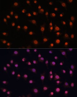 Invitrogen H2AFV Polyclonal Antibody 100 &mu;L; Unconjugated:Antibodies,