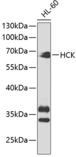 Invitrogen HCK Polyclonal Antibody 100 &mu;L | Buy Online | Invitrogen&trade; | Fisher Scientific