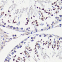 Invitrogen HFM1 Polyclonal Antibody 100 &mu;L; Unconjugated:Antibodies,