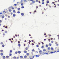 Invitrogen HFM1 Polyclonal Antibody 100 &mu;L; Unconjugated:Antibodies,