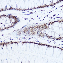 Invitrogen Histone H1.0 Polyclonal Antibody 100 &mu;L; Unconjugated:Antibodies,