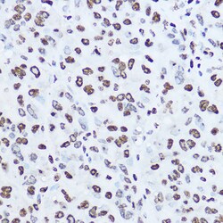 Invitrogen Histone H1.0 Polyclonal Antibody 100 &mu;L; Unconjugated:Antibodies,