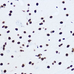 Invitrogen Histone H1.0 Polyclonal Antibody 100 &mu;L; Unconjugated:Antibodies,