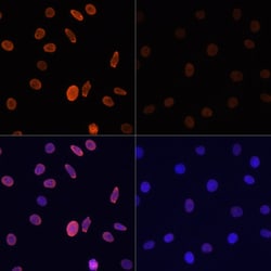 Invitrogen H2BK12ac Polyclonal Antibody 100 μL; Unconjugated:Antibodies,