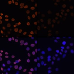 Invitrogen H2BK12ac Polyclonal Antibody 100 μL; Unconjugated:Antibodies,