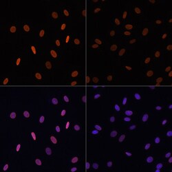 Invitrogen H2BK12ac Polyclonal Antibody 100 μL; Unconjugated:Antibodies,