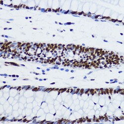 Invitrogen H2BK12ac Polyclonal Antibody 100 μL; Unconjugated:Antibodies,