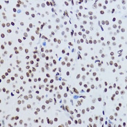 Invitrogen H2BK12ac Polyclonal Antibody 100 μL; Unconjugated:Antibodies,