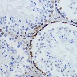 Invitrogen H2BK12ac Polyclonal Antibody 100 μL; Unconjugated:Antibodies,