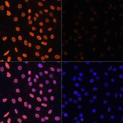 Invitrogen H3K36ac Polyclonal Antibody 100 &mu;L; Unconjugated:Antibodies,