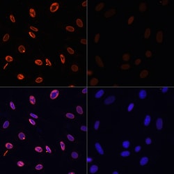 Invitrogen H3K36ac Polyclonal Antibody 100 &mu;L; Unconjugated:Antibodies,