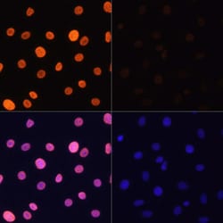 H3K4ac Polyclonal Antibody:Antibodies, Polyclonal