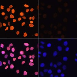 H3K4ac Polyclonal Antibody:Antibodies, Polyclonal
