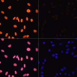 H3K4ac Polyclonal Antibody:Antibodies, Polyclonal