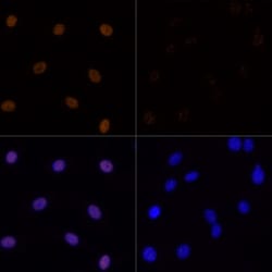 Invitrogen H3K23ac Polyclonal Antibody 100 μL; Unconjugated:Antibodies,