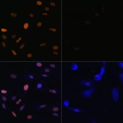 Invitrogen H3K23ac Polyclonal Antibody 100 μL; Unconjugated:Antibodies,