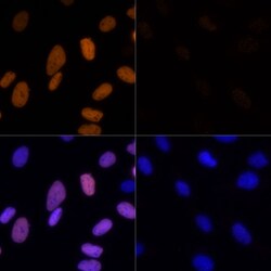 Invitrogen H3K23ac Polyclonal Antibody 100 μL; Unconjugated:Antibodies,