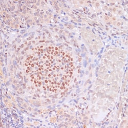 Invitrogen H3K23ac Polyclonal Antibody 100 μL; Unconjugated:Antibodies,