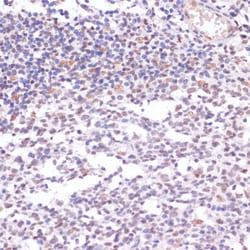 Invitrogen H3K23ac Polyclonal Antibody 100 μL; Unconjugated:Antibodies,
