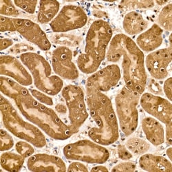 Invitrogen HN1 Polyclonal Antibody 100 &mu;L; Unconjugated:Antibodies,