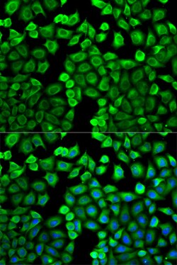 Invitrogen HNMT Polyclonal Antibody 100 μL; Unconjugated:Antibodies,