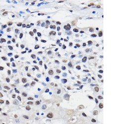 Invitrogen HNRNPU Polyclonal Antibody 100 &mu;L; Unconjugated:Antibodies,