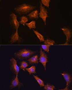 Invitrogen HOOK3 Polyclonal Antibody 100 &mu;L; Unconjugated:Antibodies,