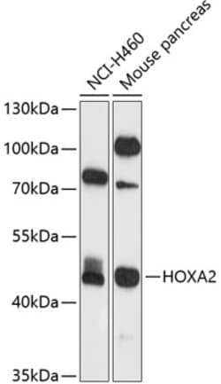 Invitrogen HOXA2 Polyclonal Antibody 100 &mu;L; Unconjugated:Antibodies,