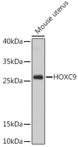 Invitrogen HOXC9 Polyclonal Antibody 100 &mu;L; Unconjugated:Antibodies,