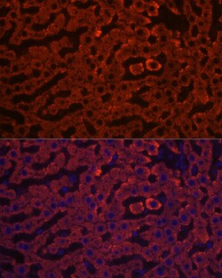Invitrogen HSD17B13 Polyclonal Antibody 100 &mu;L; Unconjugated:Antibodies,