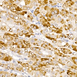 Invitrogen HSD17B13 Polyclonal Antibody 100 &mu;L; Unconjugated:Antibodies,
