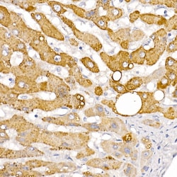 Invitrogen HSD17B13 Polyclonal Antibody 100 &mu;L; Unconjugated:Antibodies,