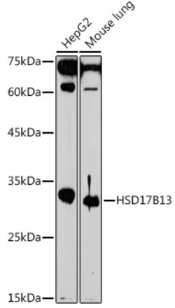 Invitrogen HSD17B13 Polyclonal Antibody 100 &mu;L; Unconjugated:Antibodies,