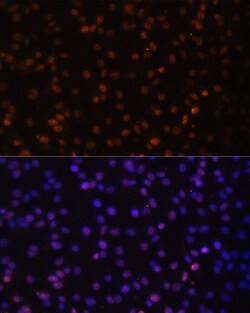 HTATSF1 Polyclonal Antibody, Invitrogen 100 &mu;L | Buy Online | Invitrogen | Fisher Scientific