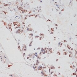 HTATSF1 Polyclonal Antibody, Invitrogen 100 &mu;L | Buy Online | Invitrogen | Fisher Scientific