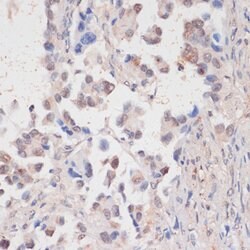 HTATSF1 Polyclonal Antibody, Invitrogen 100 &mu;L | Buy Online | Invitrogen | Fisher Scientific