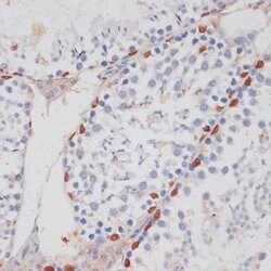 HTATSF1 Polyclonal Antibody, Invitrogen 100 &mu;L | Buy Online | Invitrogen | Fisher Scientific