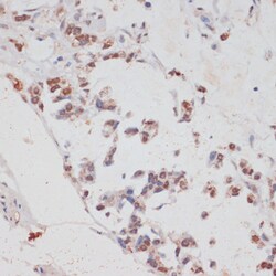 HTATSF1 Polyclonal Antibody, Invitrogen 100 &mu;L | Buy Online | Invitrogen | Fisher Scientific